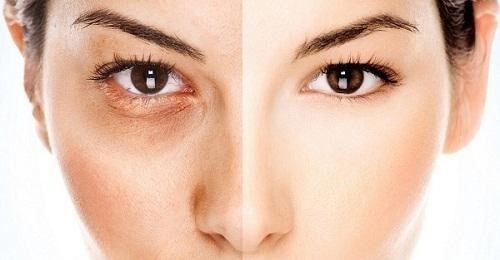 bat-mi-bi-kip-cuu-vot-lan-da-den-sam-tu-thuc-pham-tu-nhien2