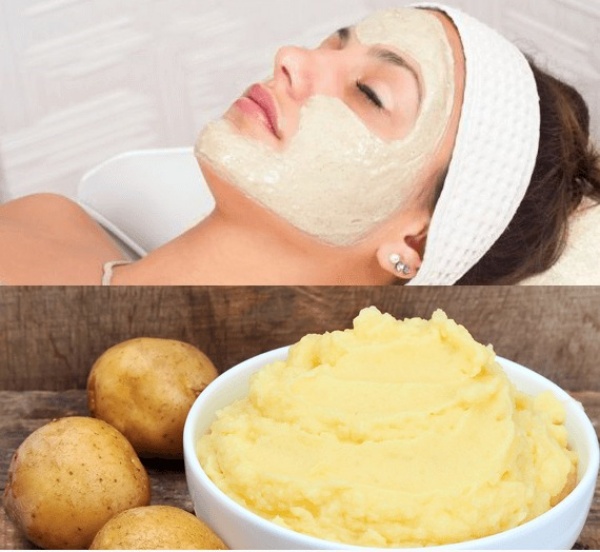 so-huu-lan-da-trang-min-nhu-em-be-voi-mat-na-khoai-tay2