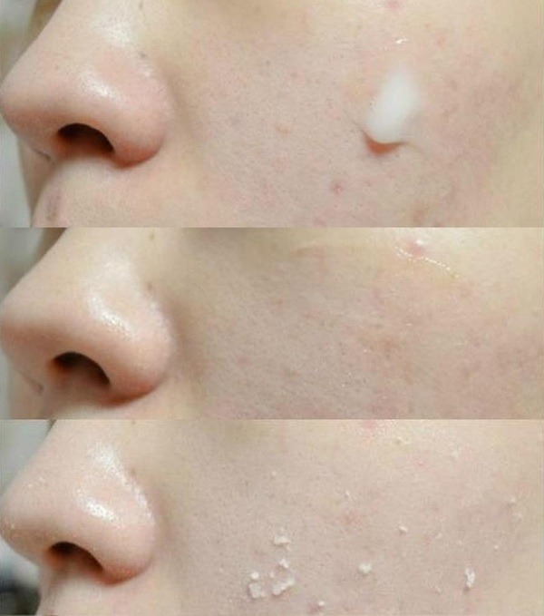 tiet-lo-bi-kip-giup-cac-nang-cham-soc-da-dau-bi-mun-hieu-qua4