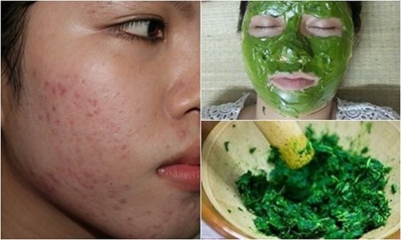 3-phuong-phap-tu-thien-nhien-tri-seo-ro-hieu-qua-nhat1