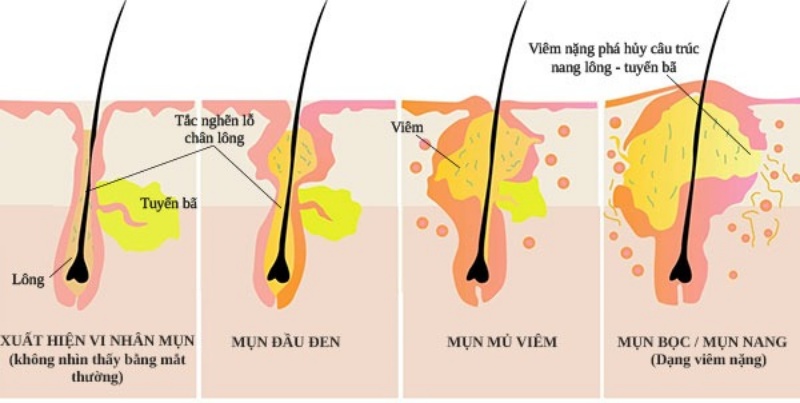 5-cach-cham-soc-da-mat-hieu-qua-tu-chuyen-gia-chi-em-can-biet2