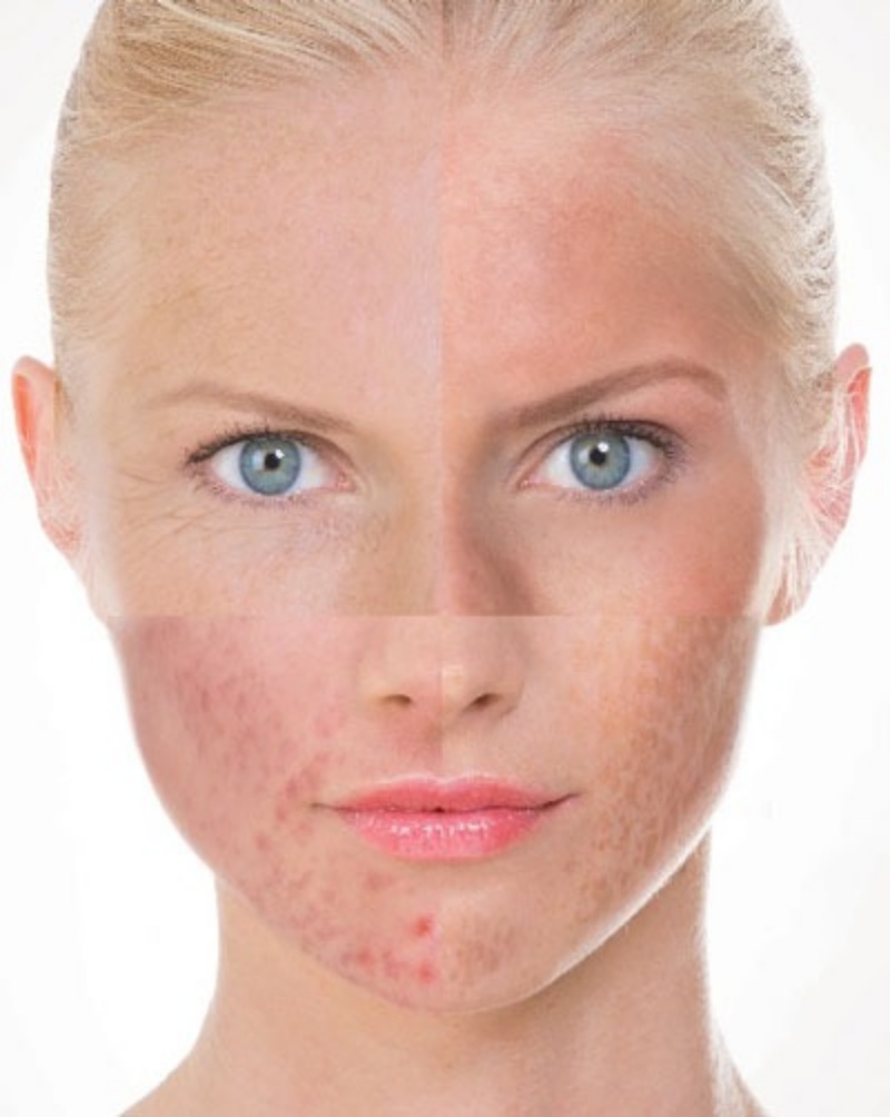 da-nhay-cam-la-gi-dac-trung-cua-da-nhay-cam2