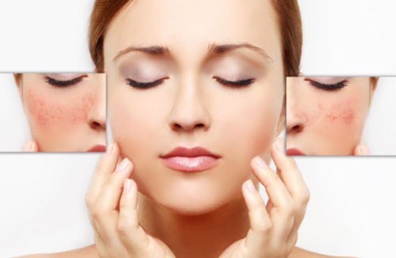 da-nhay-cam-la-gi-dac-trung-cua-da-nhay-cam3