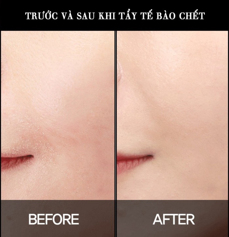 nen-hay-khong-viec-tay-te-bao-chet-cho-da-mun3