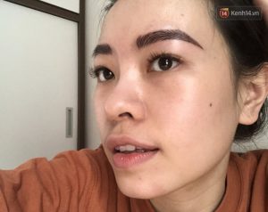 tam-su-cua-co-gai-theo-trend-khong-dung-sua-rua-mat-ket-qua-mun-moc-day-mat1