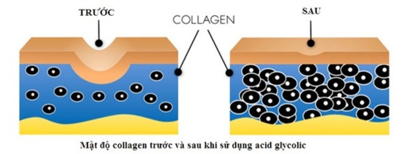 nhung-luu-y-nen-nho-khi-chon-tonner-cho-da-dau-mun3